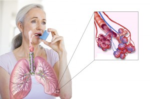 В Великобритании тестируют новый препарат от астмы