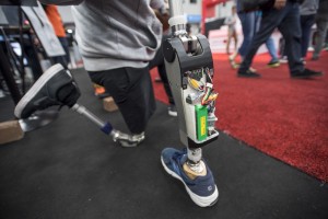 Роботизированное колено с искусственным интеллектом