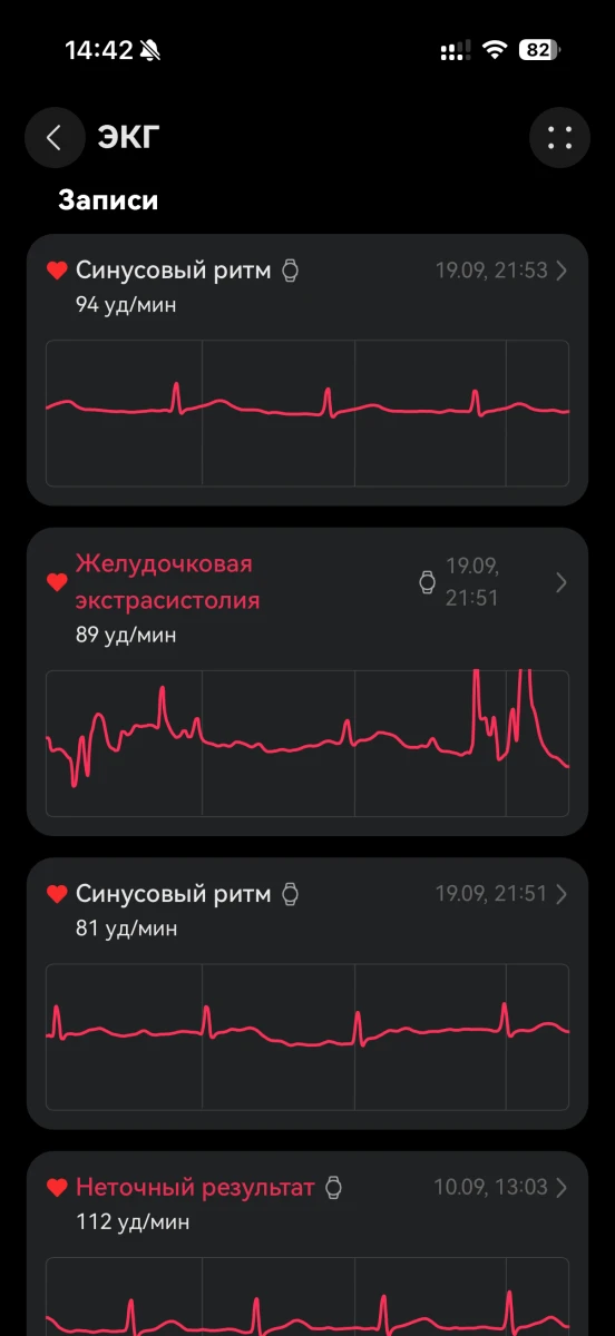 Записи ЭКГ с синусовым ритмом