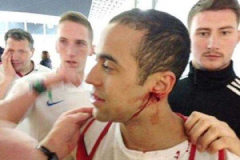 ЧМ-2014: Во время матча Англия –Уругвай болельщику откусили ухо