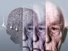 Предсказывать развитие болезни Альцгеймера научились ученые